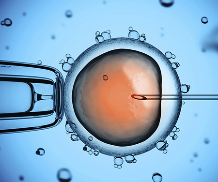 IVF Treatment