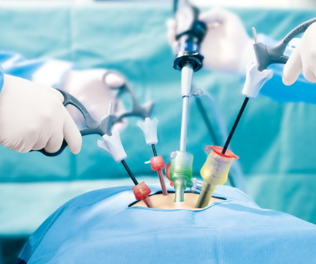 Laparoscopic Surgery